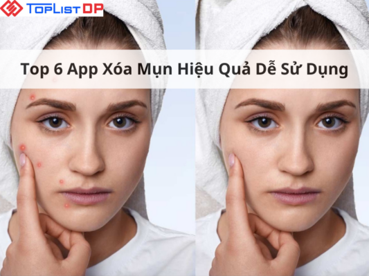 Top 6 App Xóa Mụn Thần Kỳ Giúp Bạn Tự Tin Selfie Mọi Lúc